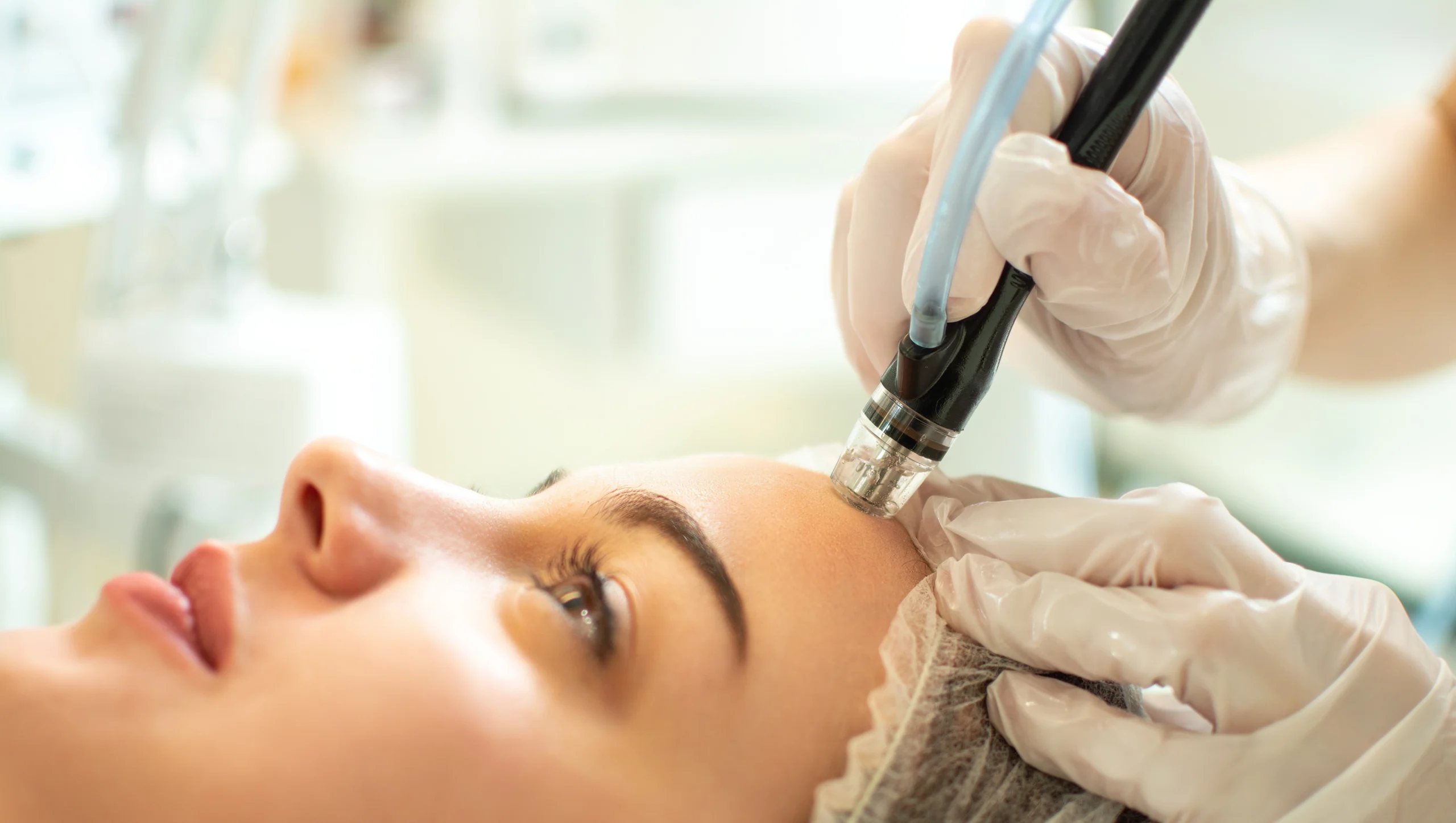 Exceedmicroneedling | | ReLux Medical Spa In Akron, OH