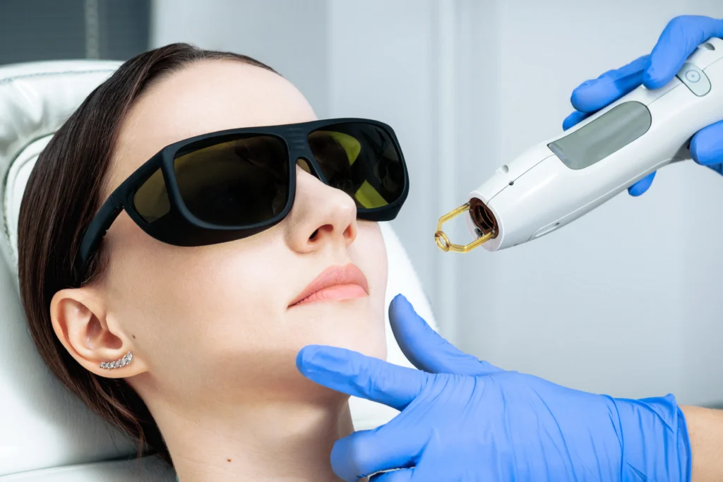 laser treatment