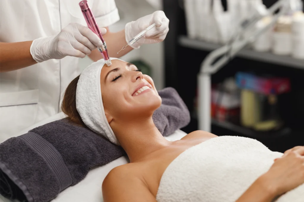 microneedling