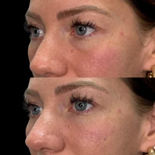 Signature Cheek and undereye ba