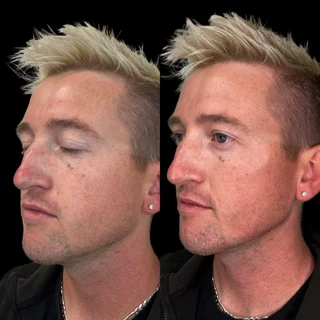 jawline man