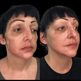 Before and After images
