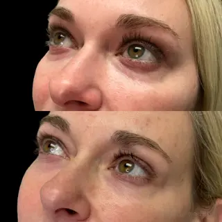 Natural Growth Factor In Akron, OH