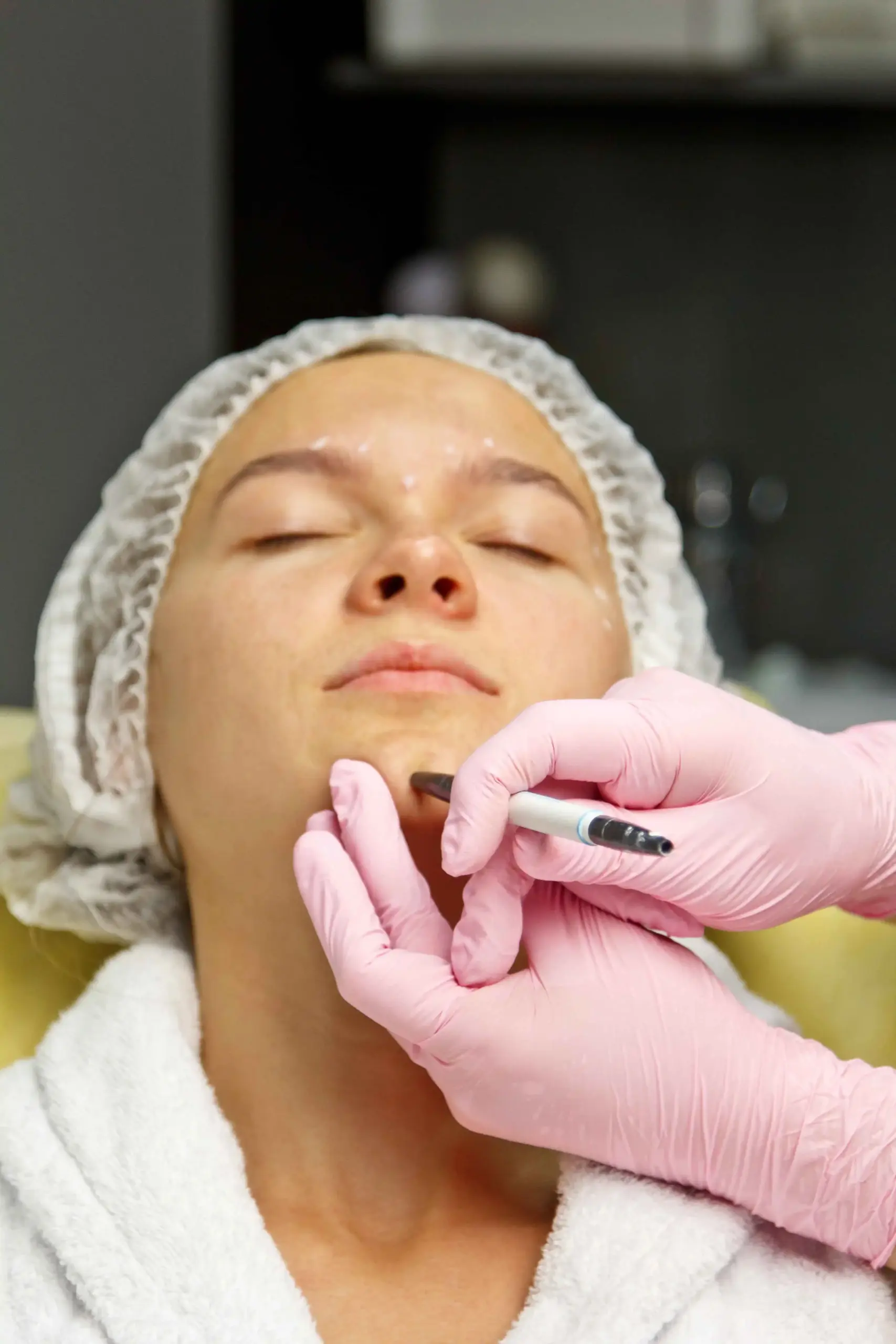 Kybella for Double Chin Reduction