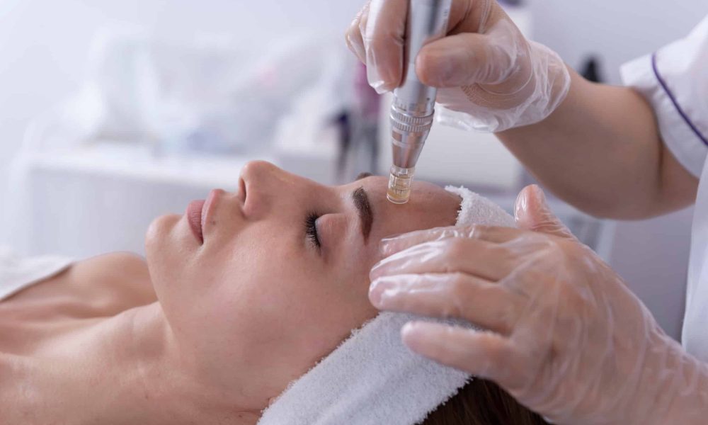 Is SkinPen Microneedling Right for You? Consultation and Treatment Options