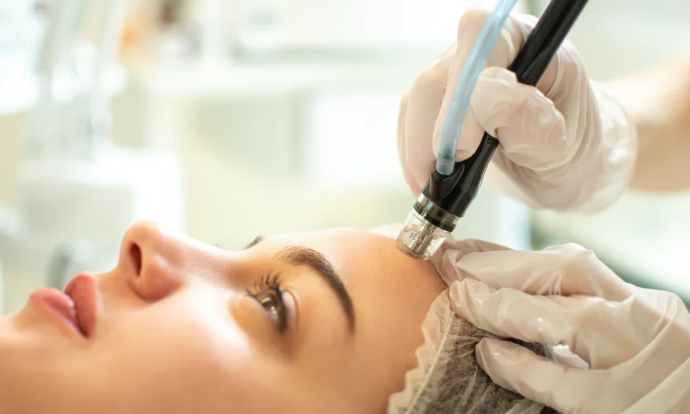 Exceedmicroneedling | | ReLux Medical Spa In Akron, OH