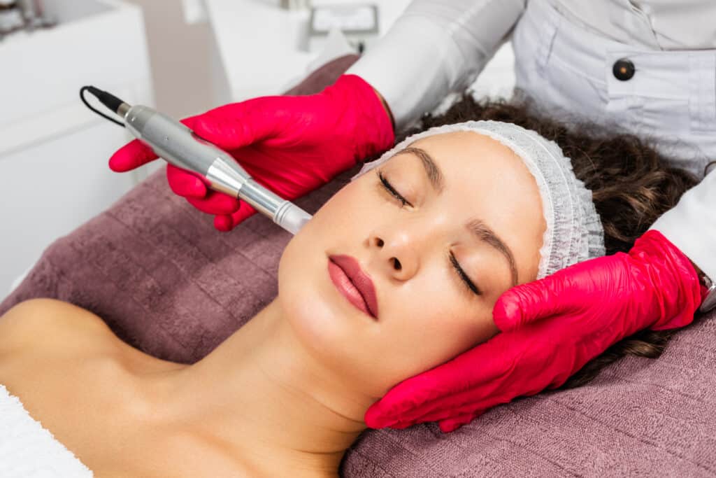 Portfolio SkinPen Microneedling at ReLux Medical Spa in Akron, Ohio.